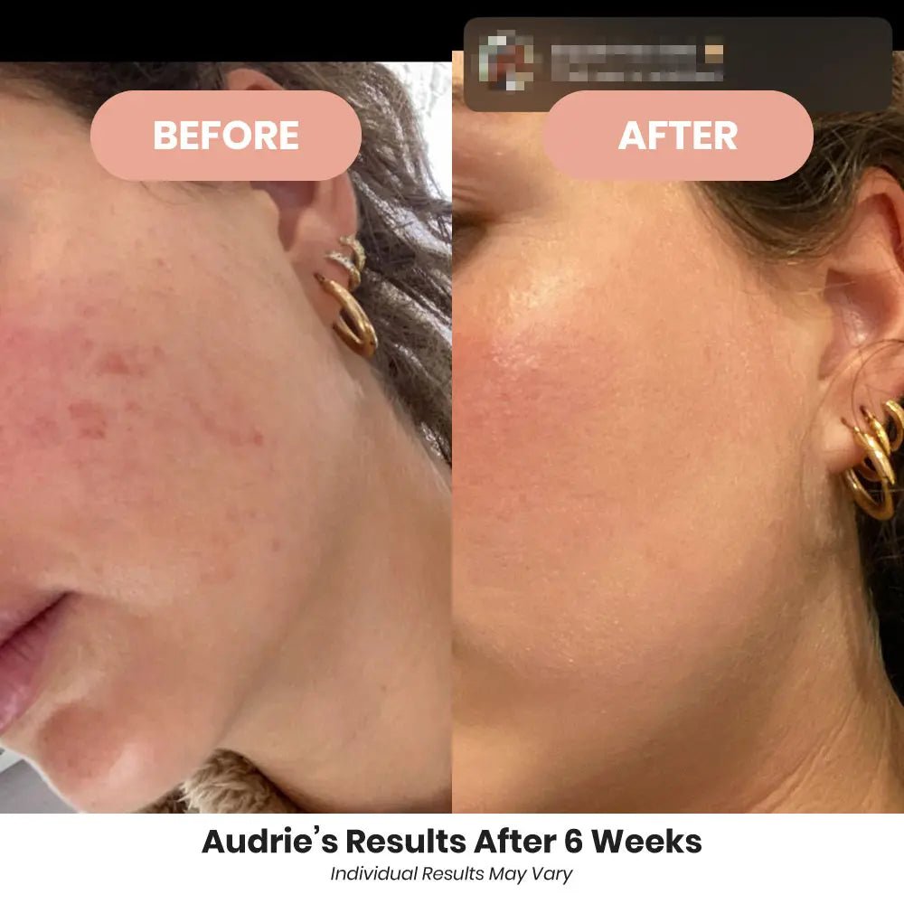 Gut Fix - Repair - 120 capsules - FixBIOMEFixBIOME5831FixBIOME_Customer-reviews_Before-After_cr_04