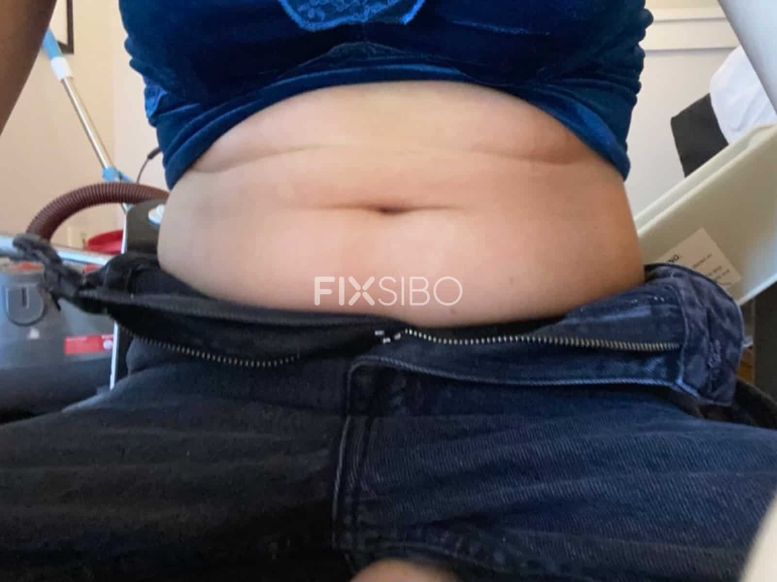 FixSIBO Patient Experience SIBO and Weight Gain 01